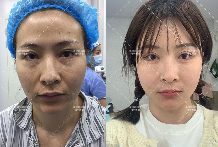 今天澳门一码一肖一特一中，全面释义、实证解答解释落实